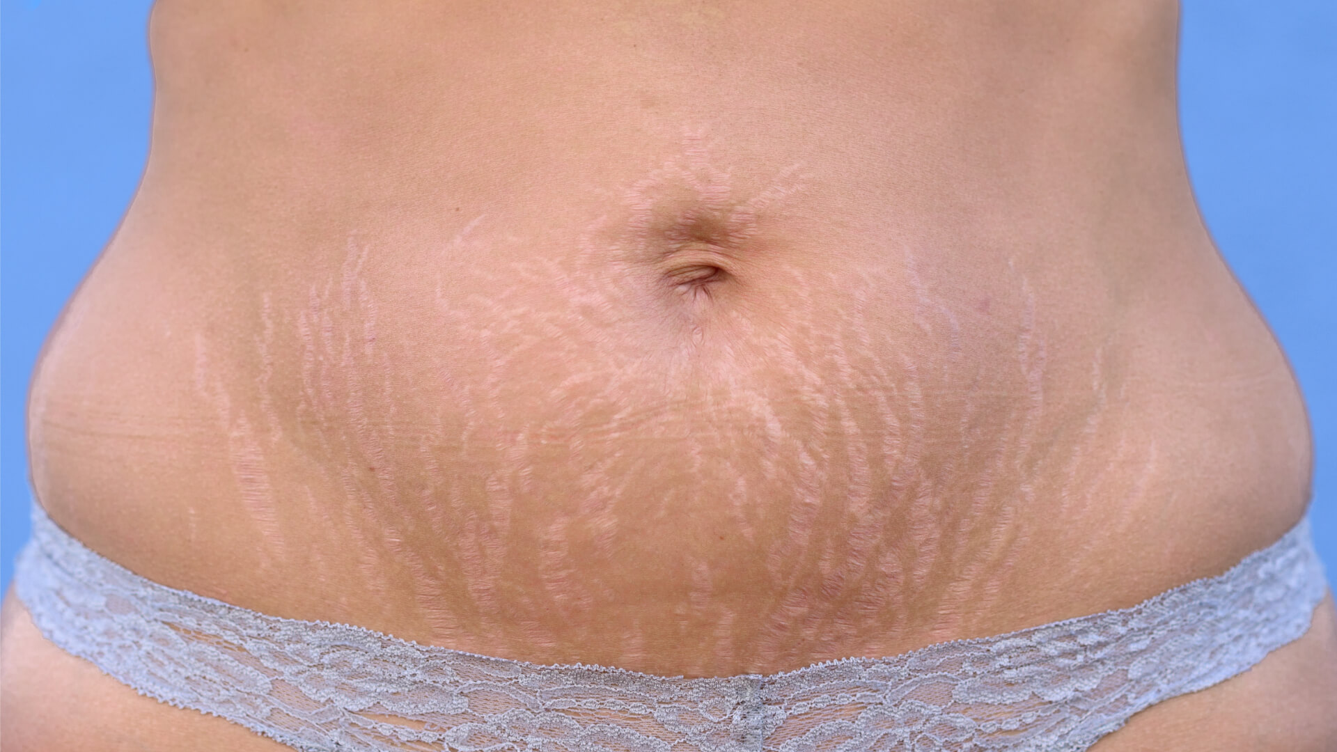 Postpartum_Body_6.jpg