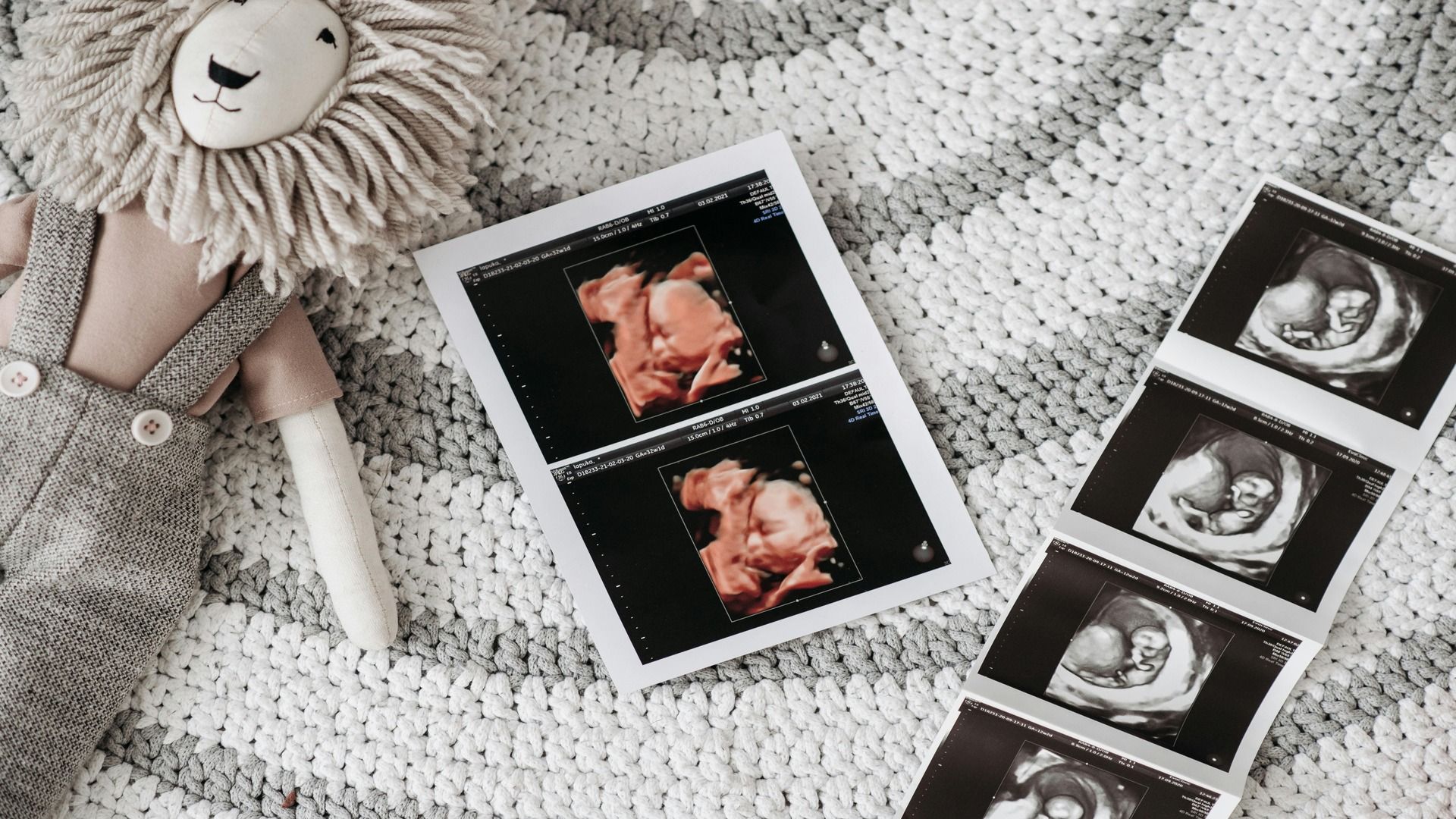 Fetal size by weeks of pregnancy height and weight